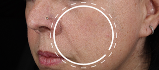 Alt text not provided for this image