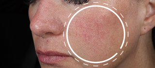 Alt text not provided for this image