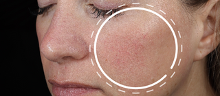 Alt text not provided for this image