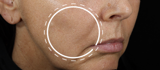 Alt text not provided for this image