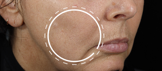 Alt text not provided for this image