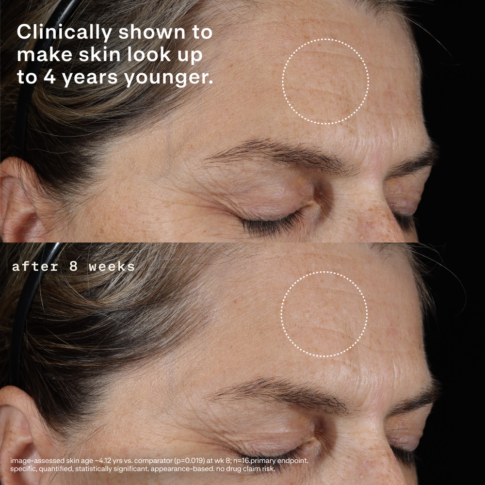 Before-and-after close-up of a woman’s eye and forehead showing reduced wrinkles after 8 weeks; overlay text: Clinically shown to make skin look up to 4 years younger. Image-assessed skin age −4.12 years vs. comparator (p=0.019) at week 8; n=16; primary endpoint. Specific, quantified, statistically significant, appearance-based. No drug claim risk.
