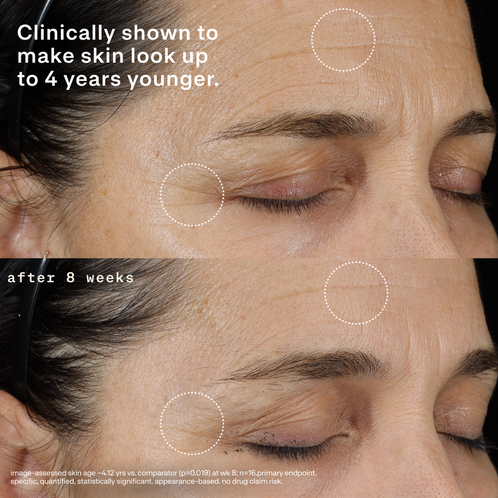 Before-and-after close-up of a woman’s eye and forehead showing reduced wrinkles after 8 weeks; overlay text: Clinically shown to make skin look up to 4 years younger. Image-assessed skin age −4.12 years vs. comparator (p=0.019) at week 8; n=16; primary endpoint. Specific, quantified, statistically significant, appearance-based. No drug claim risk.