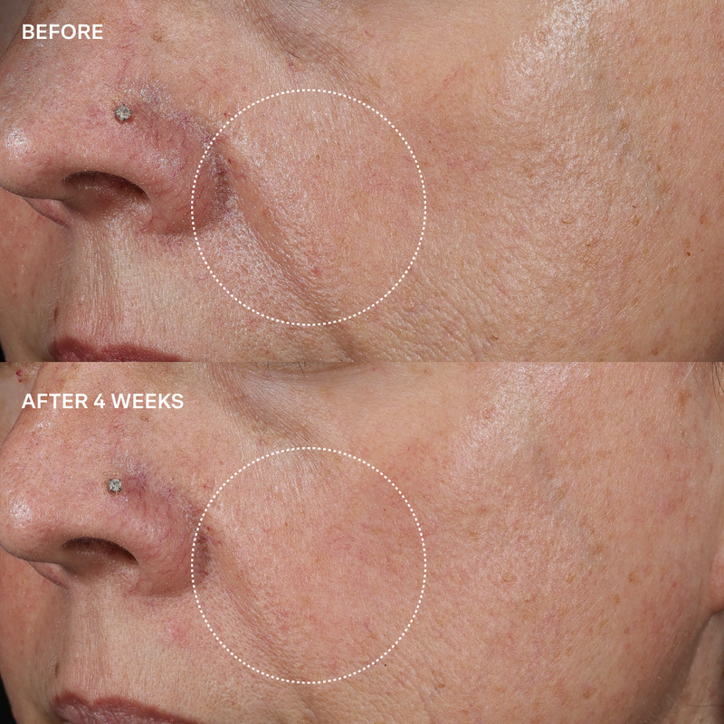 Before and after comparison