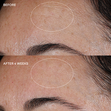 Before and after comparison